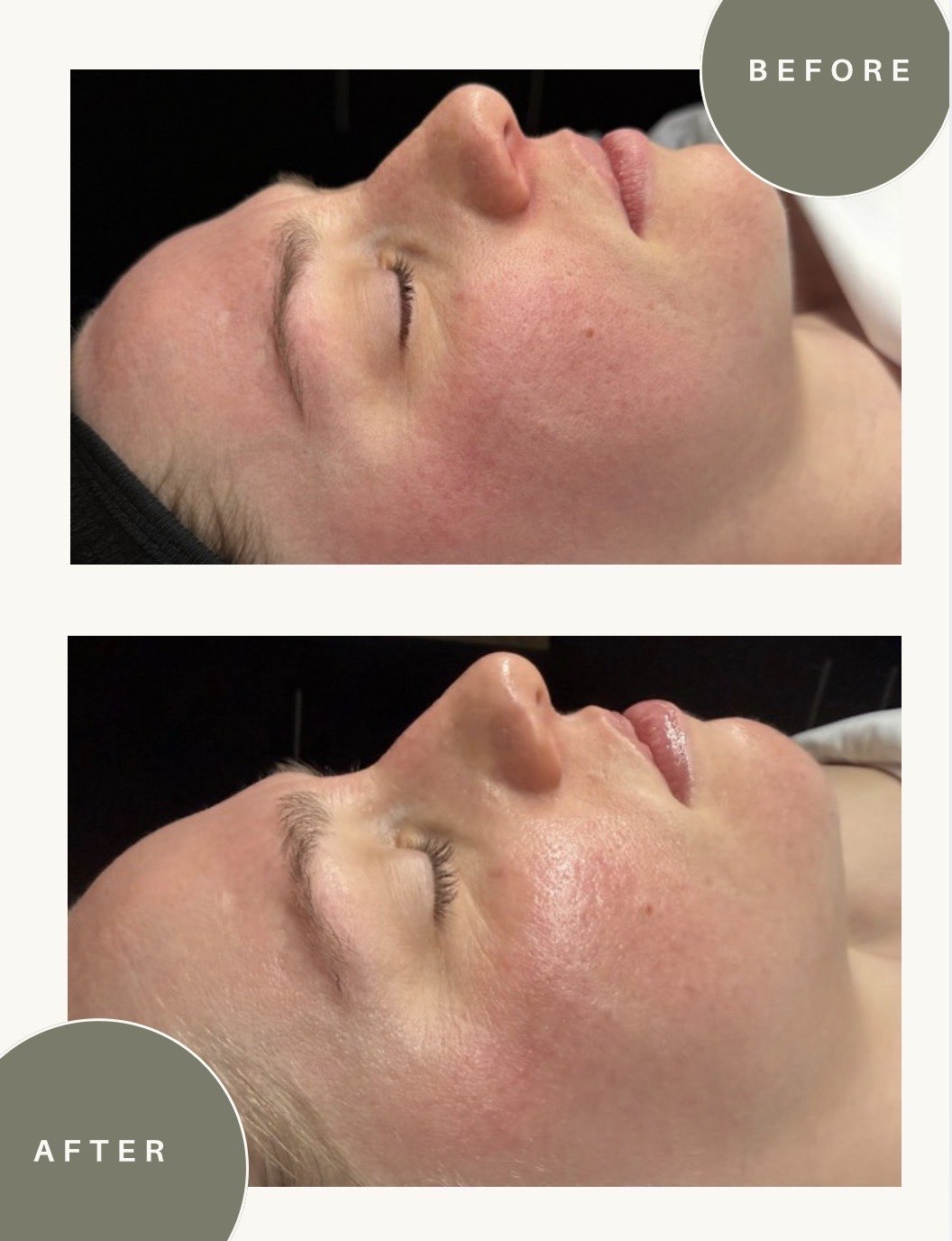 Before and after treatment