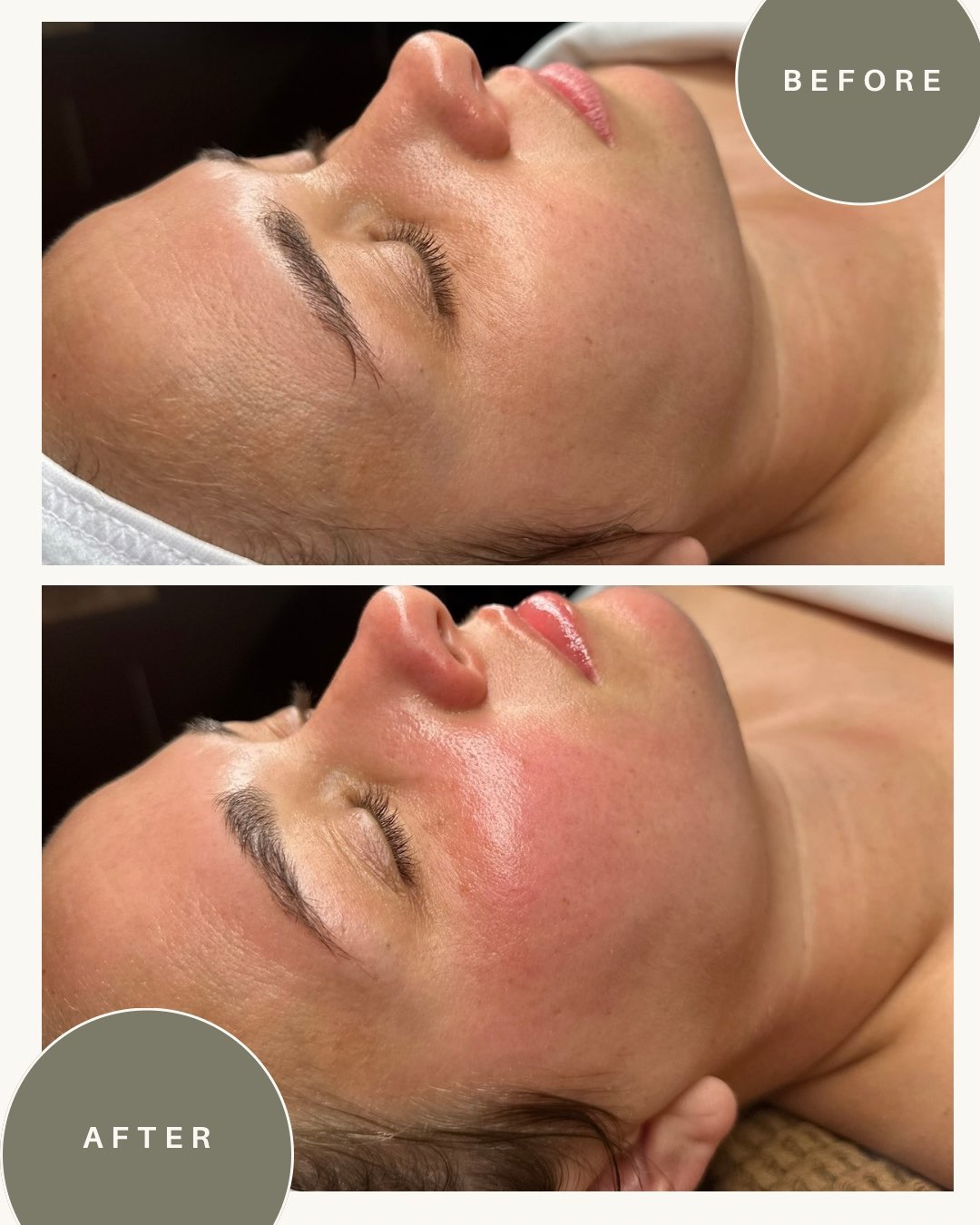 Before and after treatment